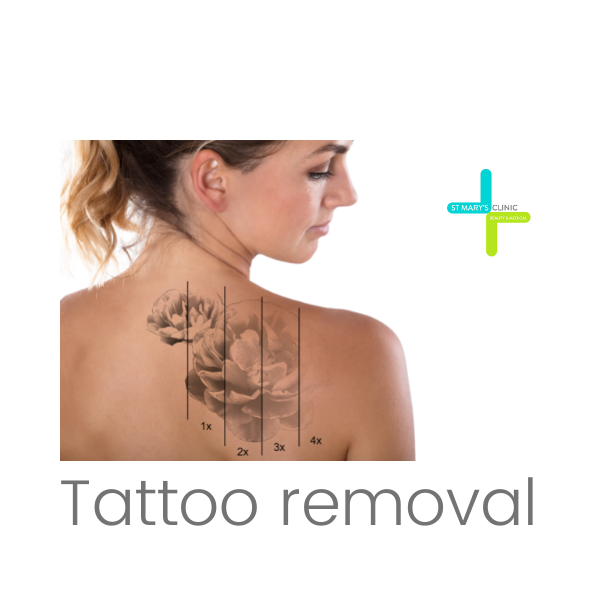 Laser Tattoo Removal  La Fameux Derma